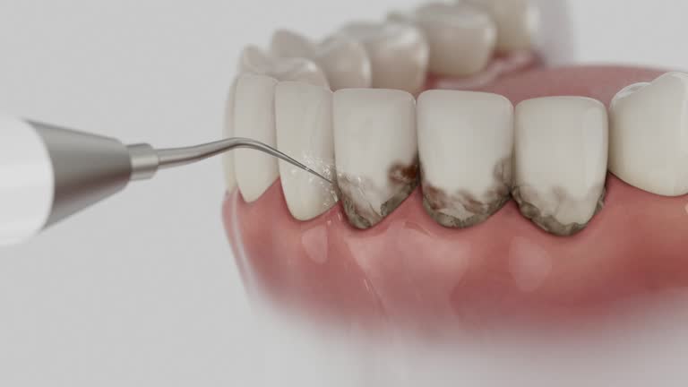 Reliable Dental Implants contractor in Granite, OK by Smile Center Dentistry
